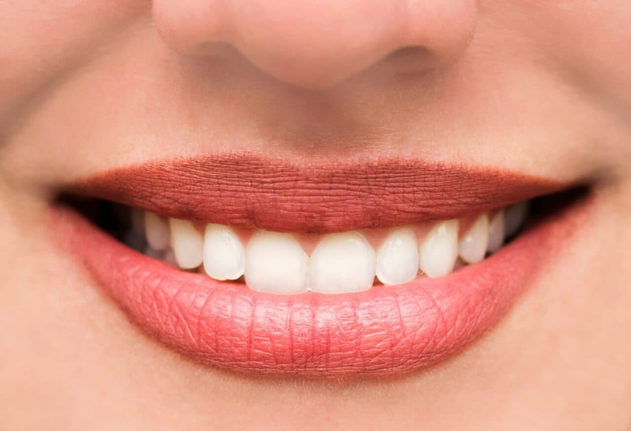 After dental treatment comparison image